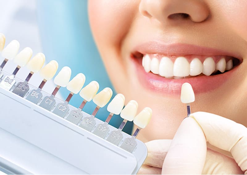 セラミック治療＆ホワイトニング