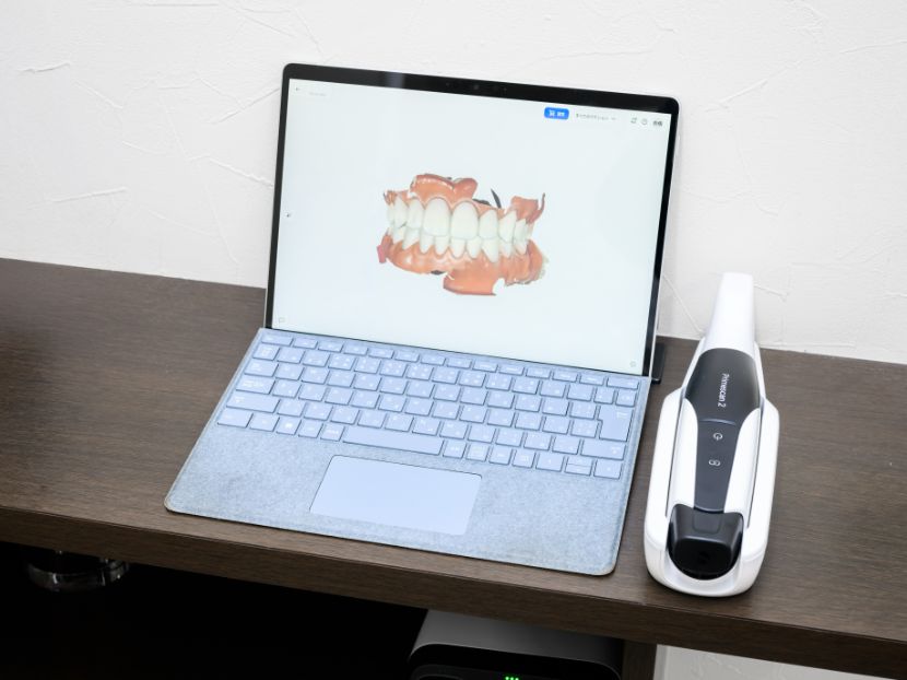 口腔内スキャナ